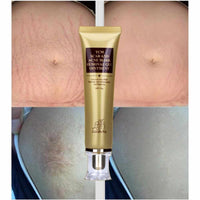 Acne and Scar Removal Gel - Golonzo -                                                                             