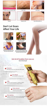 Acne and Scar Removal Gel - Golonzo -                                                                             