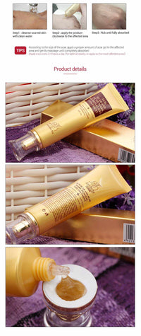 Acne and Scar Removal Gel - Golonzo -                                                                             