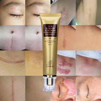 Acne and Scar Removal Gel - Golonzo -                                                                             