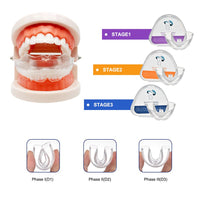 Dental Appliance Tooth Orthodontic Braces Trainer - Golonzo -                                                                             