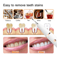 Electric Sonic Dental Calculus Scaler For Oral Teeth Tartar Remover - Golonzo -                                                                             