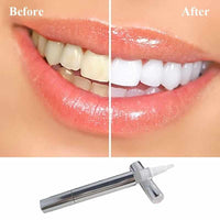 Teeth Whitening Pen - Teeth Whitening Product-Teeth Whitener-Golonzo
