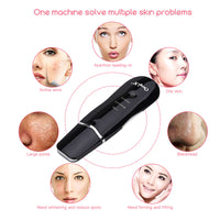 Ultrasonic Deep Face Cleaning Machine Skin Scrubber-Skin Care Tools-Golonzo