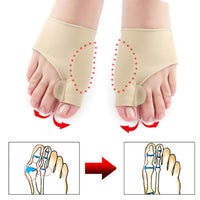 Foot Corrector for Bunions-Bunion Care Supplies-Golonzo
