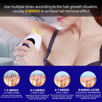 Painless Hair Remove Machine - GOOD Stuff For Ladies!-Epilators-Golonzo
