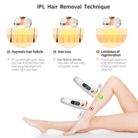 IPL Epilator Permanent Hair Removal-Hair Remover-Golonzo