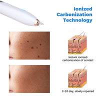 Laser Mole Tattoo Freckle Removal Pen-Facial Cleansers-Golonzo