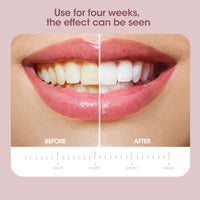 High Frequency Sonic Electric Cleaning Toothbrush-Toothbrushes-Golonzo