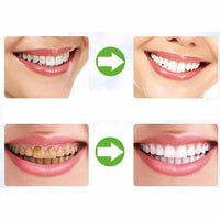 Teeth Whitening Charcoal Powder-Teeth Whitener-Golonzo