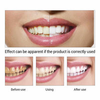 Teeth Whitening Essence-Teeth Whitener-Golonzo